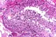 LIFELONG MUTATIONS: Spermatogenesis commences during puberty and continues throughout life and until old age because of the inexhaustible stem cell reservoir - an abundance of germ cells are developed and delivered from the seminiferous tubules / Pic: CoRus13/CC
